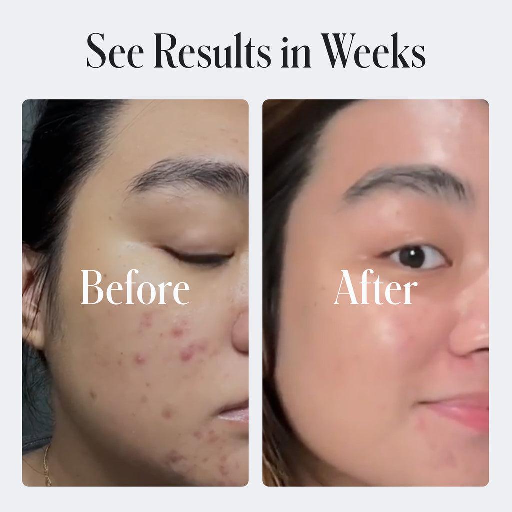 Clear System Starter Routine