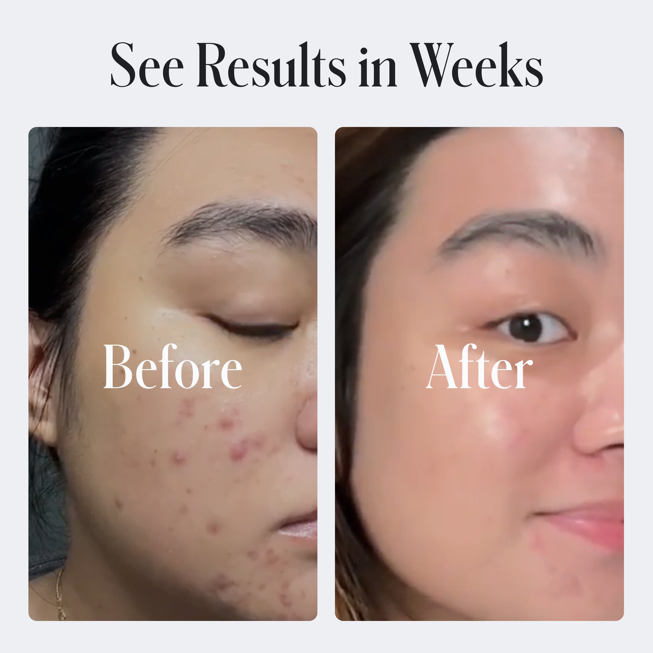 Clear System Starter Routine