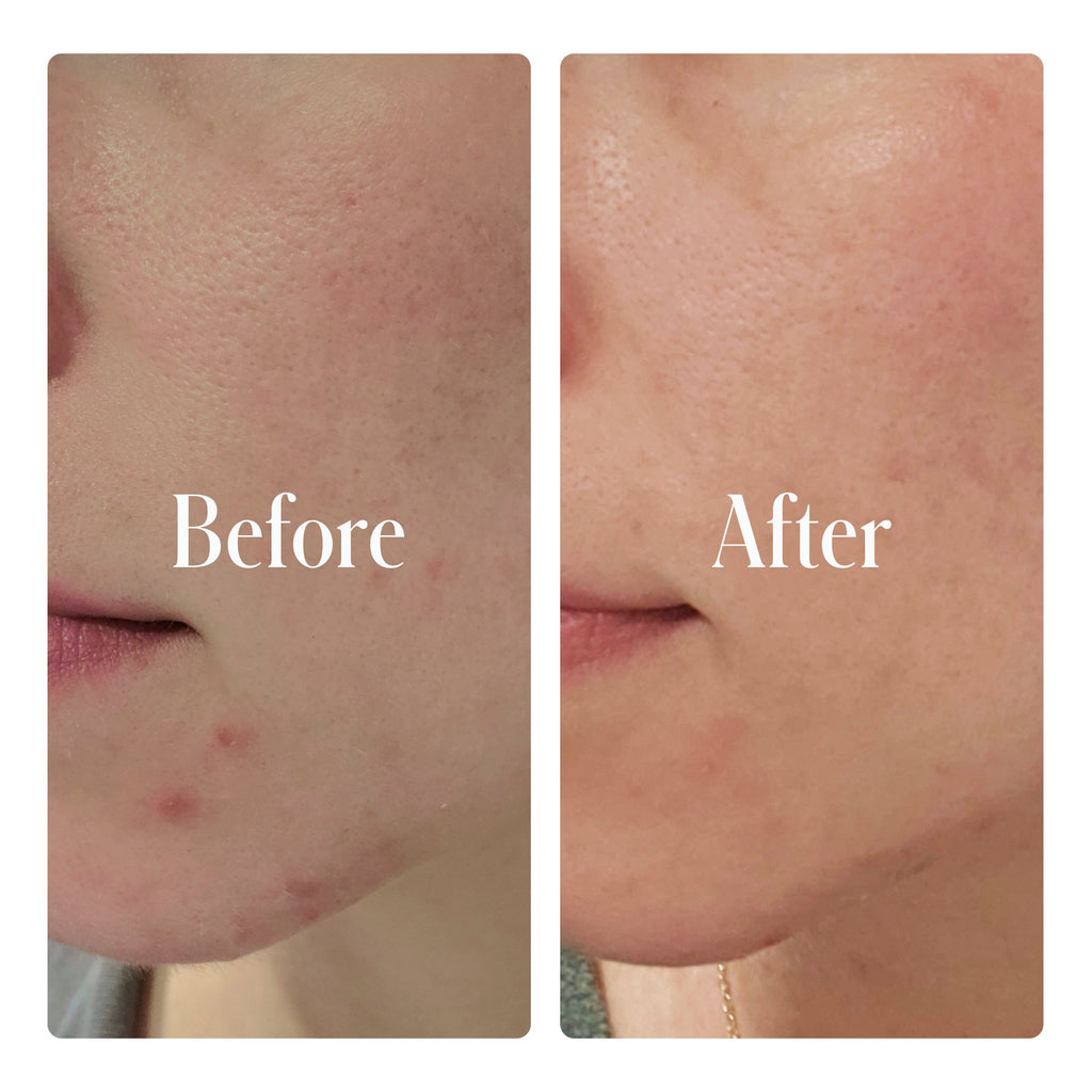 Clear System Face Routine